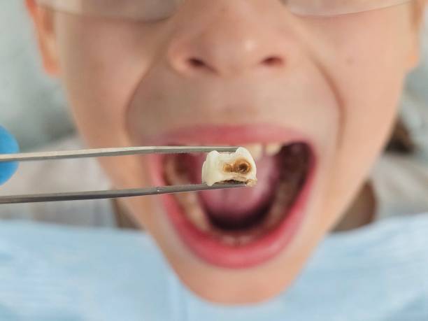 Best Emergency Treatment for Toothache in Maypearl, TX
